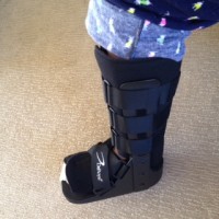 fracture boot